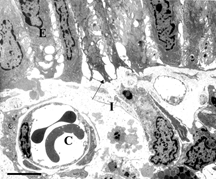 Figure 5 Electron microscopy of intestinal mucosa to assess epithelial damage. Typical electron micrograph of transverse section through intestinal villus (Peyer's patch area) 30 minutes after injection of rat with a 5 ml bolus of iron dextran (0.9 µg/ml). The epithelial cells (E) are separating from each other and from the basement membrane (arrows) and show extensive cytoplasmic protrusions. The interstitium, (I) is edematous. C: capillary containing two red blood cells; Scale bar: 5 microns.