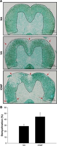 Figure 4 Treatment with ferucarbotran exacerbated demyelination in EAE mice.Notes: (A) Representative tissue sections stained with LFB are shown. Areas marked by dashed line show normal myelinated regions in the NA group. Red arrows indicate regions with marked demyelination in the VH and IONP groups. (B) The data are expressed as the mean ± standard error of 8–11 samples per group. *P<0.05 compared to the VH group. The results are representative of three independent experiments.Abbreviations: EAE, experimental autoimmune encephalomyelitis; IONP, iron oxide nanoparticle; LFB, Luxol fast blue; NA, naïve; VH, vehicle.