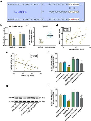 Figure 5. LncRNA DLEU2 up-regulated YWHAZ by competitively binding to miR-212-5p. (a) TargetScan v7.2 (http://www.targetscan.org/vert_72/) and (b) dual luciferase reporter assay were performed to analyze the targeting relationship between miR-212-5p and YWHAZ. (c) YWHAZ was up-regulated in atherosclerotic serum (n = 34) compared to normal serum (n = 20). (d-e) Pearson correlation method was used to analyze the correlation between YWHAZ and DLEU2 or miR-212-5p in atherosclerotic serum (n = 34). (f-h) Western blot and RT-qPCR were carried out to determine YWHAZ expression. β-actin was used as a control. *P < 0.05, **P < 0.01, ***P < 0.001 vs. PDGF-BB, ^^^P < 0.001 vs. PDGF-BB+DLEU2+ miR-NC, #P < 0.05, ##P < 0.01 vs. PDGF-BB+M; †††P < 0.001 vs. miR-NC. All experiments were repeated at least three times. Data were expressed as mean ± standard deviation. Data between two groups or among multiple groups were analyzed by independent sample t test or one-way ANOVA, followed by Tukey’s post hoc test.