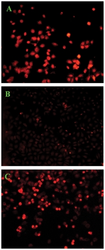 Figure 7 Confocal laser scanning microscopic images of HepG2 cells (5 × 104 cells/mL) after 12 hours of in vitro exposure to (A) free doxorubicin, (B) doxorubicin-loaded PEG-b-PLMA micelles, and (C) doxorubicin-loaded Gal-PEG-b-PLMA micelles.Abbreviations: PEG-b-PLMA, methoxy poly(ethylene glycol)/poly (l-lactide-co-β-malic acid); Gal-PEG-b-PLMA, galactosylated methoxy poly(ethylene glycol)/poly(llactide-co-β-malic acid).