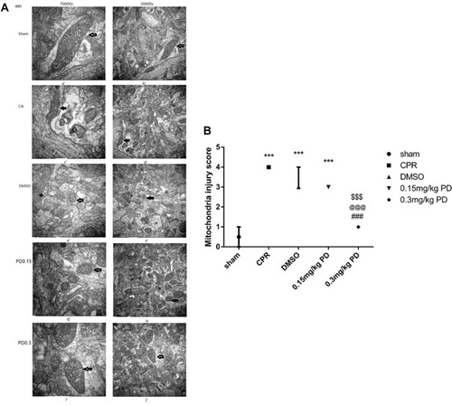 Figure 2 Mitochondrial ultrastructure and injury scores in the cerebral cortex in each of the groups. (A) Representative electron photomicrographs of mitochondria from the brain cortex. Images were acquired with an electron microscope at 30000x (scale bar, 1 μm). A 70000x closeup of the image in the left panel is shown (scale bar, 500 nm). There was mitochondria normal ultrastructure in the sham control animals (a, b). Severe mitochondrial swelling, chondrolysis and vacuolization of cristae with a concomitant loss of membrane integrity were observed at 48 h post-resuscitation (c, d) in the CA group. More extensive tumid mitochondria with disrupted cristae were observed in the DMSO group (e, f) than in the PD0.15 group (g, h), but in the PD0.3 group, a range of small ultrastructural injuries were observed (i, j) (the arrows represent mitochondria). (B) Mitochondrial injury scores in brain cortex in each of the groups. The mitochondrial injury score in the CA group was significantly higher than that in the sham group (P<0.001), but in the PD0.3 group, the mitochondrial injury score was lower than that in the other treatment groups. All data above are presented as the median± interquartile range (n=3 in each group). ***P<0.001 versus the sham group; ###P<0.001 versus the CA group; @@@P<0.001 versus the DMSO group; $$$P<0.001 versus the PD0.15 group.