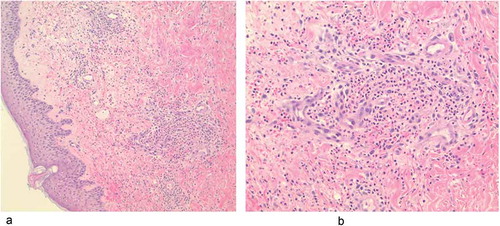 Figure 2. H&E stained slides.