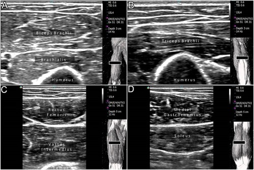 Figure 1 Ultrasound measurements of the biceps brachii (A), triceps brachii (B), rectus femoris (C), and medial gastrocnemius (D) muscles. The black square indicates ultrasound transducers.