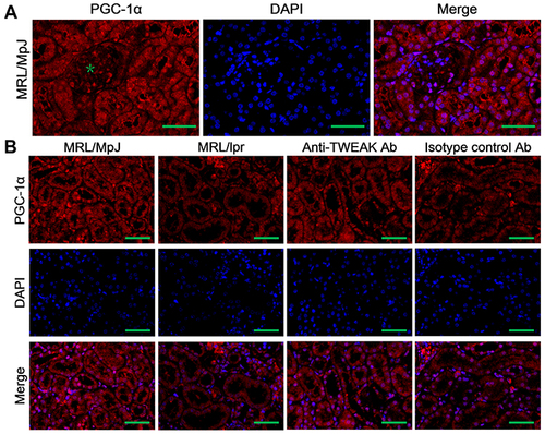 Figure 4 The expression of PGC-1α was detected using immunofluorescence staining. (A) The distribution of PGC-1α in the kidneys of MRL/lpr mice was evaluated; the green asterisk indicates the glomeruli. (B) The expression of PGC-1α was detected in mouse renal tubules. Scale bar, 100 μm; n = 5/group.