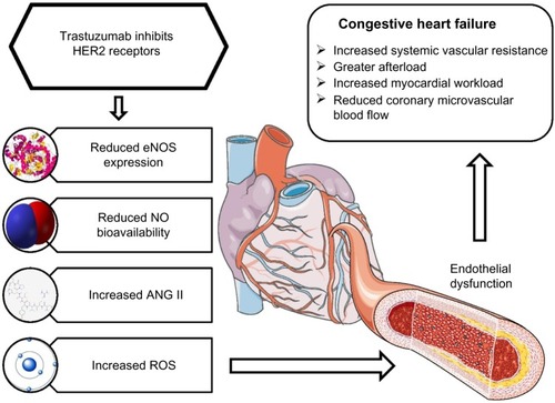 Figure 2 The effects of trastuzumab on the vasculature and its subsequent contribution to congestive heart failure.
