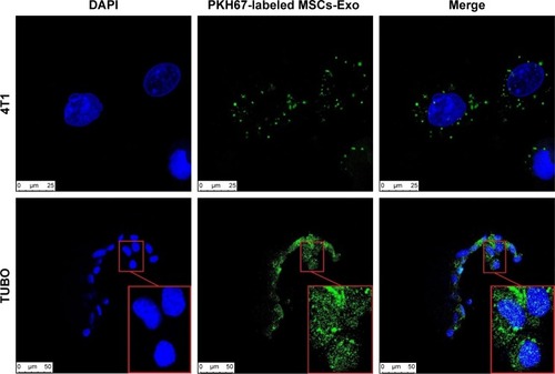 Figure 3 Cellular uptake of PKH67-labeled MSCs-Exo by 4T1 and TUBO cell lines.Note: Intracellular PKH67-labeled MSCs-Exo were detected in 4T1 and TUBO cells by confocal laser scanning microscopy after 24 hours of co-culturing (inset is a higher magnification image).Abbreviation: MSCs-Exo, mesenchymal stem cell-derived exosomes.