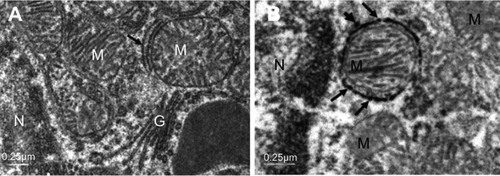 Figure 12 NiNPs intracellular localization in PT cells: (A) control group with normal ultrastructure of mitochondria, RER (arrow) and Golgi apparatus. (B) The NiNP-treated group showing electron dense particles, probably NiNPs, adhered to the RER which surround the mitochondria (arrows) and some are still free (arrow head).Abbreviations: NiNPs, nickel nanoparticles; N, nucleus; RER, rough endoplasmic reticulum; M, mitochondria; PT, proximal convoluted tubule; G, Golgi apparatus.