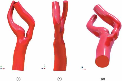 Figure 2. Complete stenosed model including bifurcation region; (a) front view (b) side view (c) perspective bottom view.
