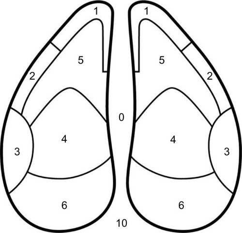 Figure 2 Claw zone diagram.