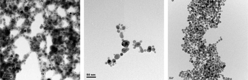 Figure 4 STEM images of samples #12–14: (left) MesoSilver, (middle) Silver Wings, (right) Coated Silver.