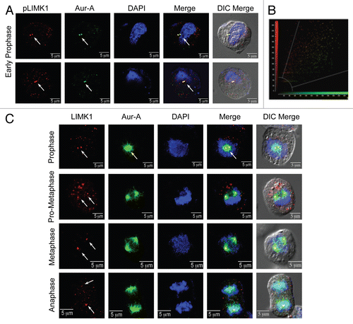 Figure 1 LIMK1 and Aur-A colocalized to the centrosomes in mitotic cells. (A) Upper and lower parts: immunofluorescence analysis of pLIMK-pT508 (red) and Aur-A (green) in PC-3 cells. DNA was counterstained with DAPI. Colocalization of pLIMK1 with Aur-A in early prophase was mainly to the centrosomes (white arrows). (B) Pearson's correlation of colocalization between LIMK1 and Aur-A from (A). (C) Immunofluorescence of LIMK1 (red) and Aur-A (green) during mitosis. A distinct colocalization of pLIMK1 (only pLIMK1 localizes to the centrosomes) and Aur-A at the centrosomes during prophase was evident. Strong association of Aur-A with the microtubules also could be noted. At prometaphase, continued localization of pLIMK1 at the separating centrosomes along with Aur-A could be noted (white arrows). In metaphase, redistribution of pLIMK1 at the spindle poles but not at the spindle microtubules and its sustained colocalization with Aur-A was seen (white arrows). In anaphase, pLIMK1 remained colocalized with Aur-A to the poles of the elongated spindle. All pictures are representatives of at least three independent experiments. Scale bar 5 µm.