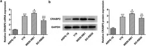 Figure 1. The expression level of CRABP2 in RB cells. CRABP2 mRNA (a) and protein expression (b) in RB cells and ARPE-19 cells were respectively detected by RT-qPCR analysis and Western blot. ***P < 0.001 vs. ARPE-19 group. #P < 0.05 vs. Y79 group. ∆∆P < 0.01 and ∆∆∆P < 0.001 vs. WERI-RB1 group.
