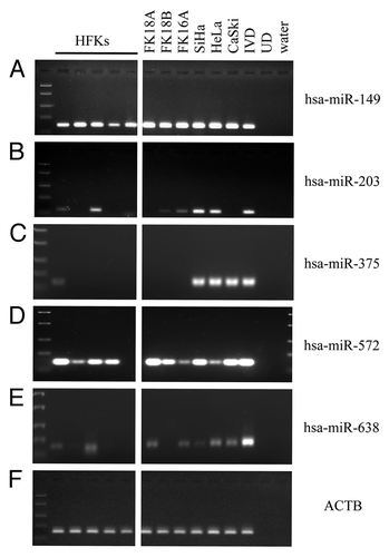 Figure 1. Methylation patterns of selected miRNAs in the cell line panel. Methylation as determined in human foreskin keratinocytes (HFKs), HPV-transformed keratinocyte cell lines FK16A, FK18A and FK18B (reminiscent of high-grade CIN), and cervical cancer cell lines SiHa, HeLa and CaSki is shown for (A) hsa-miR-149, (B) hsa-miR-203, (C) hsa-miR-375, (D) hsa-miR-572 and (E) hsa-miR-638. In (F) ACTB results are shown, indicating successful modification and comparable input for all samples. In vitro methylated DNA (IVD) and unmodified DNA (UD) were included as a positive and negative control, respectively.