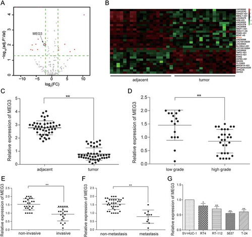 Figure 1. MEG3 was low expressed in bladder urothelial carcinoma. (A) R package showed the differentially expressed lncRNAs in bladder urothelial carcinoma after analyzing lncRNAs expression profiles from 19 paired tissues of TCGA; (B) Heat map. R package showed the expression of the differentially expressed lncRNAs. MEG3 was one of the down-regulated lncRNAs; (C) RT-qPCR demonstrated that MEG3 was low expressed in bladder urothelial carcinoma tissues after comparing 45 tumor tissues with 45 adjacent tissues; (D) RT-qPCR demonstrated that MEG3 expression level in high-grade bladder urothelial cancer was lower than that in low-grade bladder urothelial cancer after comparing 29 high-grade cancer tissues with 16 low-grade cancer tissues; (E) RT-qPCR revealed that MEG3 production in muscular invasive bladder cancer was lower than that in non-muscle invasive bladder cancer after comparing 20 muscular invasive cancer tissues with 25 non-muscle invasive cancer tissues; (F) RT-qPCR showed that MEG3 expression in metastatic bladder cancer was lower than that in non-metastasis bladder cancer after comparing 10 metastatic cancer tissues with 35 non-metastasis cancer tissues; (G) RT-qPCR showed the expression of MEG3 in different BC cell line and normal cell line. *P < 0.05, **P < 0.01, compared with adjacent tissues, low grade bladder urothelial cancer, non-invasive bladder cancer or non-metastasis bladder cancer. Each RT-qPCR was repeated three times.