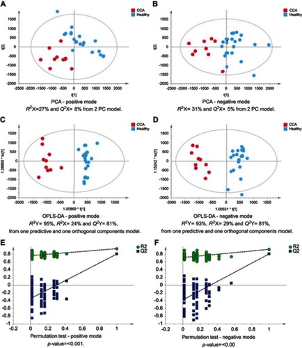 Figure 1 CCA patients vs healthy controls. PCA scores plots for (A) positive and (B) negative ion mode data of CCA patients and healthy controls. OPLS-DA scores plots showing group separation for both (C) positive and (D) negative ion mode data and the corresponding permutation tests for (E) positive and (F) negative ion mode data.Abbreviations: CCA, cholangiocarcinoma; PCA, principal component analysis; OPLS-DA, orthogonal projections to latent structures discriminant analysis.