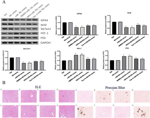 Figure 6. The effect of miR-761 on ferroptosis and the liver pathology change after different reagents interference. (A) Changes of GPx4, Nrf2, SLC7A11, HO-1 and P53 levels after different mixture of miR-761 interference; (B) the liver pathology change after different reagents interference as shown by both H-E (left panel) and Prussian Blue (right panel) staining. Ctrl group (A), PCOS group (B), vehicle + PCOS group (C), NC agomir + vehicle + PCOS group (D), miR-761 agomir + vehicle + PCOS group (E), Fer-1 + PCOS group (F), NC agomir + fer-1 + PCOS group (G) and miR-761 agomir + fer-1 + PCOS group (H). *p < .05; **p < .01.