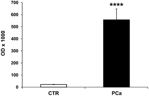 Figure 3. Detection, quantification and characterisation of CAIX+/CD81+ exosomes purified from PCa and CTR plasma by ELISA test. ELISA analysis of CAIX and CD81 expression in exosomes purified from plasma of 8 PCa patients and 8 CTR (1 ml for each sample). Rabbit polyclonal anti-CD81 antibody was used for the capture of exosomes on the plate. Expression levels of exosomal CAIX were expressed as means ± ES. The p values was <.0001 in PCa plasma exosomes respect to CTR plasma exosomes. ****p < .0001.