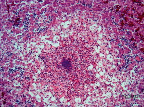 Figure 5. Liver with multifocal heterophilic-necrotic hepatitis associated with bacterial aggregates and diffuse steatosis of the hepatocytes; bar = 50 µm.