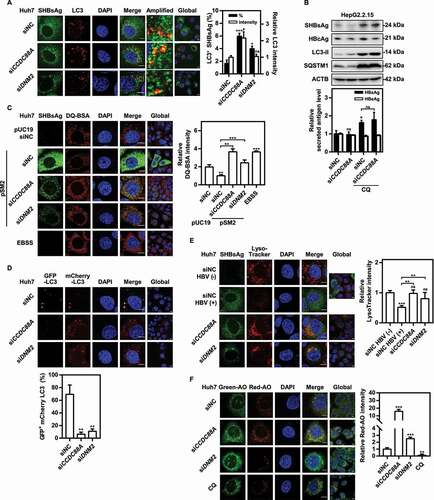 Figure 7. CCDC88A or DNM2 silencing leads to increased autophagic flux and HBV antigens degradation. (A) Huh7 cells were cotransfected with pSM2 and siCCDC88A or siDNM2 for 48 h. The colocalization of SHBsAg and LC3 was imaged. Scale bar: 10 μm. (B) HepG2.2.15 cells were transfected with siCCDC88A, and then treated with 10 μM CQ, and harvested after 72 h. The expression of SHBsAg, HBcAg, LC3 and SQSTM1 (upper) and the levels of HBsAg and HBeAg in the supernatants (below) were quantified. (C) Huh7 cells were cotransfected with pSM2 or empty plasmid pUC19 and siCCDC88A or siDNM2, and harvested after 48 h and then incubated with DQ-BSA Red for 30 min. The fluorescent signal of DQ-BSA Red produced by autolysosomal proteolysis was evaluated. Scale bar: 10 μm. (D) Huh7 cells were cotransfected with the mCherry-GFP-LC3 plasmid and siCCDC88A or siDNM2, and harvested after 48 h. The mCherry and GFP signals were examined by confocal microscopy. Scale bar: 10 μm. (E and F) Huh7 cells were cotransfected with pSM2 and siCCDC88A or siDNM2. The fluorescence intensity of LysoTracker Red (E) or AO (F) were analyzed. Scale bar: 10 μm. The fluorescence intensity of target proteins, and the colocalization between target proteins or with organelle marker proteins were analyzed using ImageJ software. The results presented in the graphs were calculated from at least 5 cells. *, #p < 0.05; **p < 0.01; ***p < 0.001; ns, not significant.