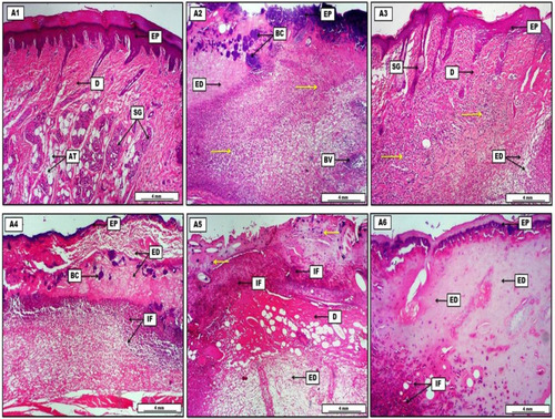 Figure 5 Photomicrograph of skin from groups. (A1) Control group, displays normal morphological organization of the epidermis (EP), presence of many sebaceous glands (SG) together with adipose tissues (AT) within the typical dermis (D). (A2) Paw-edema positive group, shows significant infiltration of polymorphonuclear inflammatory cells (yellow arrows), associated with severe pinkish edematous fluid (ED), some blood vessels (BV) within the dermis are engorged with inflammatory cells, and the section shows many bacterial colonies (BC) just under inflamed epidermis (EP). (A3) Paw edema with dexamethasone 1 mg/kg group, reveals significant reduction in the amount of edema (ED) and the number of inflammatory cells (yellow arrows) within the dermis (D), and the section displays constant regeneration of the epidermal layers (EP) together with some sebaceous glands (SG). (A4) Paw edema with aliskiren 15 mg/kg group, shows some regenerative changes within the epidermis (EP), the dermis still contains a significant amount of eosinophilic edema (ED) and significant numbers of inflammatory cells (IF), and the presence of some basophilic bacterial colonies (BC) within the dermis. (A5) Paw edema with aliskiren 30 mg/kg group, displays a reduction in the numbers of inflammatory cells (IF) and bacterial colonies (yellow arrows), the dermis (D) still infiltrated with edematous fluid (ED). (A6) Paw edema with aliskiren 60 mg/kg group, shows obvious reduction in the inflammatory cells (IF), presence of various amount of light pinkish proteinaceous edema (ED) within the dermis, and the epidermis (EP) reveals noticeable morphological regeneration. H&E. Scale bars: 4 mm.