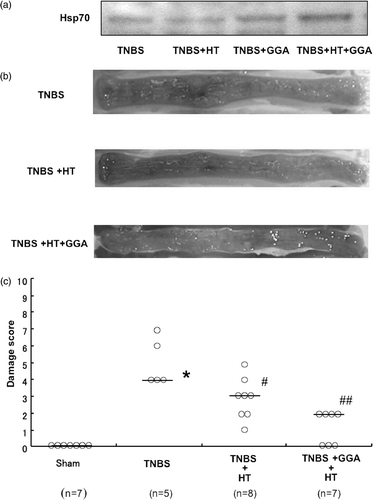 Figure 8. Effect of geranylgeranylacetone on hyperthermia in TNBS-induced colitis. (a) Effects of GGA on HT-induced Hsp70 in colonic mucosa. (b) The macroscopic changes of the luminal side of the distal colon were observed 6 days after the enema of TNBS. (c) Effects of GGA on the damage score in TNBS colitis treated with HT. *p < 0.01 vs. sham, #p < 0.05 vs. TNBS, ##p < 0.01 vs. TNBS.