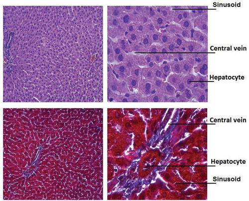 Figure 4. Microscopy of liver samples in diabetic rats receiving gavage of walnut oil with medium dose of β-sitosterol; (a) H&E (20 µm); (b) H&E (100 µm); (c) trichrome (20 µm); (d) trichrome (100 µm).