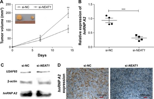 Figure 9 Knocking down NEAT1 inhibited HepG2 cell growth and downregulated hnRNP A2 expression in vivo.