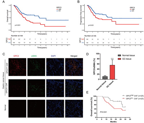 Figure 4. GC with GPC3high CAFs is correlated with poor prognosis. (A,B) Kaplan–Meier survival curve shows the relationship between high- and low-GPC3 expression and GC prognosis with TCGA dataset. (C) Immunofluorescence were used to detect the GPC3 expression in CAFs of GC tissue and normal tissue (bar = 50 μm). (D) Comparison between the GPC3 expression level in CAFs of GC tissue and normal tissue. (E) Kaplan–Meier survival curve shows the relationship between high- and low-GPC3 expression in CAFs and OS of GC patients (***p < .001).