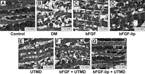 Figure 2 Preventing cardiomyocyte from DM injury by bFGF-lip.Notes: Electron micrographs (magnification ×10,000) of left ventricular heart muscle sections from the rats of each group. N=8 per group. The Z represents the Z-line in myofiber and the M represents the mitochondria. As shown in (A–G), alterations in myofilaments and the Z-lines of myofiber, destruction and loss of myofibrils over sarcomere units, and swollen mitochondria were observed in DM group rats. The damage to myocardial cell in bFGF-treated rats was obviously attenuated particularly in the group that combined bFGF-lip with UTMD compared with DM group and other groups.Abbreviations: DM, diabetes mellitus; bFGF, basic fibroblast growth factor; bFGF-lip, bFGF-loaded liposome; UTMD, ultrasound-targeted microbubble destruction.