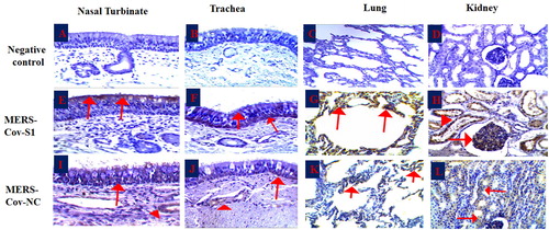 Figure 4. Immunohistochemistry of the MERS-CoV natural infected dromedary camels. A-D: Nasal turbinate, trachea, lungs and kidney respectively showed no signal; E-F: Nasal turbinate and trachea showed signals of MERS-CoV-S1 viral antigen in the epithelial surfaces; G: pulmonary alveoli showed signals of MERS-CoV-S1 viral antigen, H: MERS-CoV-S1 antigen was detected in both glomerular epithelia (arrow) and renal tubules (arrow head); I-J: Nasal turbinate and trachea showed weak signals of MERS-CoV-NC viral antigen in both epithelial surfaces (arrow) and sub-epithelial glands (arrowhead); K: Pulmonary alveoli showed weak signals of MERS-CoV-NC viral antigen; L: Renal tubules showed weak signals of MERS-CoV-NC viral antigen.