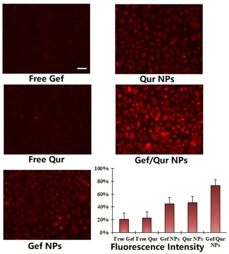 Figure 4 Cellular uptake of DiR-loaded NPs, free Gef, free Qur, Gef NPs, Qur NPs and Gef/Qur NPs for 2 h by PC-9 cells. Quantitative results of cellular uptake of different groups. The bar was 10 μm.