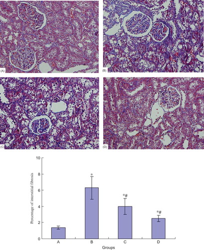 Figure 1. Tubulointerstitial fibrosis of rats in different groups by Masson staining (×100). *p < 0.05 compared with normal group, #p < 0.05 compared with DN group. (A) Control group; (B) DN group; (C) DN + NCTD (0.05 mg/kg/day) group; (D) DN + NCTD (0.1 mg/kg/day) group.