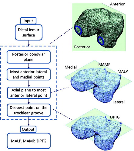 Figure 1. Chart of the automatic algorithm to compute the segmentation of the most anterior lateral and medial points, along with the deepest point of the trochlear groove.