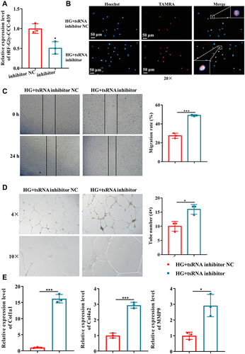 Figure 6 tRF-Gly-CCC-039 inhibitor suppressed high-glucose-induced impairment in HUVECs. (A) Relative expression of tRF-Gly-CCC-039 in HUVECs after transfection of the tRF-Gly-CCC-039 inhibitor or inhibitor NC. (B) The proliferation of HUVECs after transfection of the tRF-Gly-CCC-039 inhibitor or NC was detected by using the EdU assay. (C) The migration ability of HUVECs after transfection of the tRF-Gly-CCC-039 inhibitor or NC was detected by using the wound-healing assay. (D) The tube-formation ability of HUVECs after transfection of the tRF-Gly-CCC-039 inhibitor or NC was detected by using the Matrigel tube-formation assay. (E) Matrix-associated gene expression (Col1a1, Col4a2, and MMP9) in HUVECs after transfection of the tRF-Gly-CCC-039 inhibitor or NC was detected by using RT-qPCR. Red represents the HG + tsRNA inhibitor NC group, and blue represents the HG + tsRNA inhibitor group. *p < 0.05, ***p < 0.001.