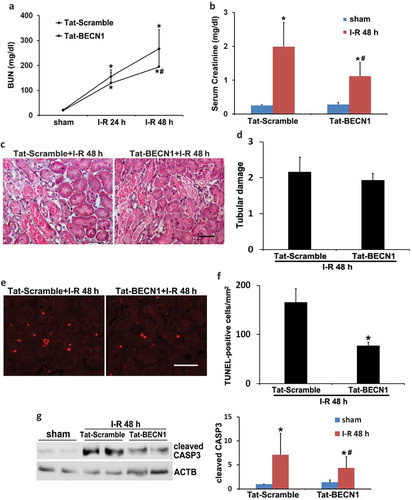 Figure 4. Pharmacological preconditioning with Tat-BECN1 protects against renal IRI in C57BL/6 mice. C57BL/6 mice were pretreated with Tat-BECN1 and its control peptide (Tat-Scramble) at a single dose of 20 mg/kg i.p. injection. Four h after preconditioning, mice were subjected to 27-min bilateral renal ischemia followed by 24 to 48 h of reperfusion (sham: n = 3 for each; Tat-Scramble + I-R: n = 8; Tat-BECN1 + I-R: n = 10). Blood and kidneys were collected at the indicated time points for renal function, histology and immunoblot analyses. (a and b) BUN and serum creatinine. Data are expressed as mean ± SD. *, P < 0.05, significantly different from the sham group; #, P < 0.05, significantly different from Tat-Scramble + I-R group. (c) Representative histology of renal cortex and outer medulla H-E staining. Scale bar: 50 µm. (d) Pathological score of tubular damage. (e) Representative images of TUNEL staining. Scale bar: 50 µm. (f) Quantification of TUNEL-positive cells. Data in (d and f) are expressed as mean ± SD. *, P < 0.05, significantly different from Tat-Scramble + I-R group. (g) Representative blots and densitometric analysis of cleaved CASP3. ACTB was used as a loading control. After normalization with ACTB, the protein signal of Tat-Scramble + sham was arbitrarily set as 1, and the signals of other conditions were normalized to the Tat-Scramble + sham to calculate fold changes. Data are expressed as mean ± SD. *, P < 0.05, significantly different from the sham group; #, P < 0.05, significantly different from Tat-Scramble + I-R group.