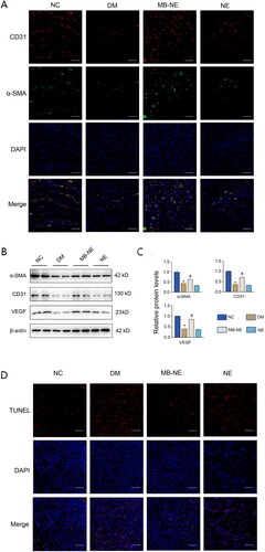 Figure 3. Pro-angiogenic and anti-apoptotic effects of MB-NE on diabetic mouse wounds. (A, B) Western blotting and quantitative analysis of α-SMA, VEGF and CD31 in wound tissue of diabetic mice. (C) Expression of CD31 and α-SMA in wound detected via immunofluorescence staining. Scale bar: 100 μm. (D) TUNEL staining showing apoptosis in each group. scale bar: 100 μm. NC, control group; DM, diabetic group; MB-NE, diabetic group + methylene blue nanoemulsion; NE, diabetic + blank nanoemulsion group. *p < 0.05, vs. NC, #p < 0.05, vs. DM.