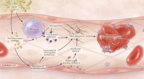 Figure 5 Mechanisms of DIC in sepsis involving endothelial dysfunction and platelet activation.