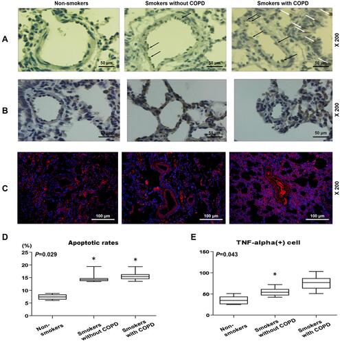 Figure 2 Pulmonary vascular endothelial apoptosis and higher TNF expression were observed in smokers, with a higher severity in smokers with COPD. (A) Representative TUNEL staining images of lung tissues from non-smokers and smokers with or without COPD at 200× magnification. (B) Immunohistochemistry analysis of TNF-α in lung tissue from non-smokers and smokers with or without COPD. (C and E) Immunofluorescence analysis of TNF-α from non-smokers and smokers with or without COPD. (D) Apoptosis rate of lung tissues from non-smokers and smokers with or without COPD was quantified. Black and white arrows were all positive cells. All experiments were performed in triplicate and experimental data were expressed as mean ± standard errors (SE). *P<0.05, vs Non-smokers.