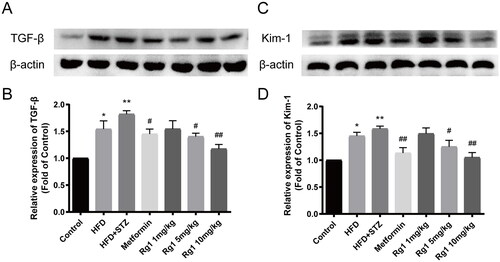 Figure 5. Effect of Rg1 on the expression of TGF-β and Kim-1 in the renal cortex of T2DM mice. (A) The bands of TGF-β (Western blotting). (B) The relative expression of TGF-β over control. (C) The bands of Kim-1 (Western blotting). (B) The relative expression of Kim-1 over control. The data are expressed as the mean ± SD, n = 4, *p< 0.05, **p< 0.01 compared with the control group; #p< 0.05, ##p< 0.01 compared with the HFD + STZ group.