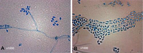 Figure 2 Colonies stained with lactophenol cotton blue dye after tableting and coating and subsequently observed under a microscope (1000× magnification). Clear and divided mycelia could be observed with slender, branched, and tapered tips (A). Conidium stalks appeared pear-shaped and were clustered similarly to flowers (B). Conidium was arranged conically along the axis.