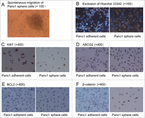 Figure 3. (A). Spontaneous migration. After serum was added into the medium, Panc1 cell spheres in DMEM/F-12 containing bFGF, EGF, B27 and insulin adhered to the bottom in 96-well plates and many cells from the edges of the spheres migrated out of the spheres spontaneously and then gradually spreaded in the whole bottom of the plate. (B). Exclusion of Hoechst 33342. After incubation with Hoechst 33342 (2.5 μg/ml), the fluorescent staining of Panc1 sphere cells was significantly weaker than that of Panc1adherent cells. (C). Almost all of the Panc1 adherent cells were Ki67 positive, whereas few Panc1 sphere cells were Ki67 positive. (D, E and F). Expression levels of ABCG2, BCL2 and ß-catenin were much higher in Panc1 sphere cells than in Panc1 adherent cells. ß-catenin was localized to the cell membrane of adherent cells, whereas it was localized to the cytoplasm and nucleus of sphere cells.