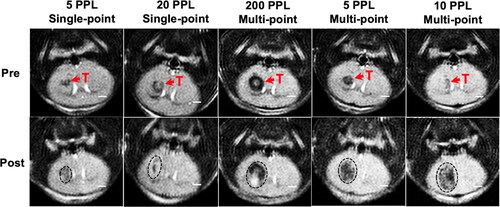 Figure 7. Representative pre- and post-treatment T2-weight MRI for LL/2-luc2 tumors. Each column represents one mouse. The tumor (T) is represented by a hypointense region in the pre-treatment images, and the ablation zone (black outline) is represented by a larger hypointense region in the post-treatment images. Ablation regions increased with dosage. All scale bars = 2 mm.