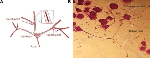 Figure 8 Effect of different treatments (NGF–MNPs–quercetin) on morphological parameters of neuronal differentiation, comparing between the four treatments: free NGF, non-conjugated MNPs with free NGF, NGF–MNPs + quercetin, and NGF + quercetin (A, B). (C) The number of neurites originating from the soma. Scale bar set at 30 µM. (D) The number of branching points. ANOVA test, *P<0.05, **P<0.01. Figure 9 Immunofluorescence images of differentiated PC12 cells 5 days after treatment with iron oxide nanoparticles. (A) Control, (B) cells stained with DAPI, (C) cells stained with β3-tubulin, and (D) the merge of (B) and (C). Green and blue fluorescence represent β3-tubulin and nucleus, respectively. Nuclei marked with DAPI.Display full sizeAbbreviations: MNPs, magnetic nanoparticles; NGF, nerve growth factor; Q, quercetin.