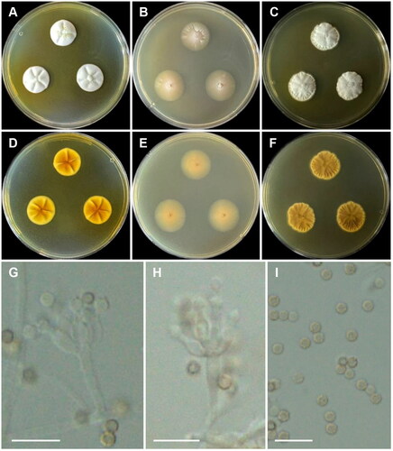 Figure 8. Morphology of Penicillium labradorum CNUFC MOP1. (A, D) Colonies on Czapek yeast autolysate agar (CYA); (B, E) malt extract agar (MEA); (C, F) yeast extract sucrose agar (YES) (A–C: obverse view and D–F: reverse view); (G, H) Conidiophores; (I) Conidia. Scale bars = 10 µm.