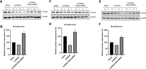 Figure 5 Western blot analysis of N-cadherin expression in the mouse ST by PEG-SWNTs. The effect of PEG-SWNT administration route on N-cadherin expression was evaluated in PD mice ST. (A and B) N-cadherin expression in Method 1; (C and D) N-cadherin expression in Method 2; (E and F) N-cadherin expression in Method 3. (One-way ANOVA, *P < 0.05; n = 4 for each group).