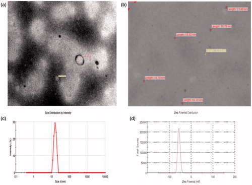 Figure 3. Surface morphology of formulation F6 by TEM. (a) Prepared by SE; (b) Prepared by HPH; (c) Globule size distribution (HF6); and (d) zeta potential determination (HF6).