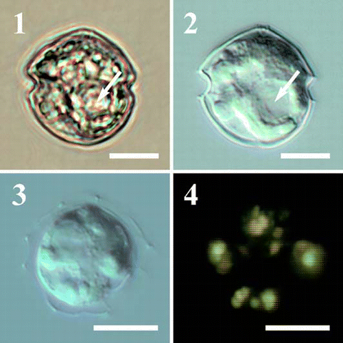Figs 1–4. Light micrographs of Protoperidinium vorax sp. nov. Fig. 1. Cell in bright field, sac pusule arrowed. Fig. 2. Same specimen as in Fig. 1 with Nomarski interference contrast, sac pusule arrowed. Fig. 3. Broken cell, note the globular bodies randomly distributed in the cytoplasm. Fig. 4. Same specimen as Fig. 3 with epifluorescence microscopy under blue light. The globular bodies appear yellow–green. Scale bars represent 10 µm.