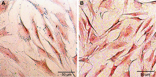 Figure S2 Fontana–Masson staining of Mn2+-PEG-MNP-labeled and unlabeled BMSCs. (A) Black particles representing Mn2+-PEG-MNPs were observed in the cytoplasm of labeled BMSCs. (B) Black particles were not observed in the cytoplasm of labeled BMSCs. Magnification =200×. Scale bars =50 µm.Abbreviations: BMSCs, bone marrow-derived stem cells; MNPs, melanin nanoparticles; PEG, polyethylene glycol.