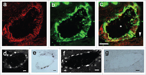 Figure 6. PGT protein localization in blood vessels. (A–C) confocal microscopic views of a venous blood vessel. (A) expression of PGT protein (B) expression of von Willbrand Factor, an endothelial marker. (C) double-stained image of PGT and von Willbrand Factor. PGT was expressed in endothelial cells of the venous blood vessels (whose lumen is indicated by the asterisk) and arachnoid membrane (arrowhead). (D, F) COX-2 protein expression in a subarachnoidal blood vessel (d) and a parenchymal blood vessel (f). (E, G) PGT mRNA expression in subarachnoidal blood vessel (e) in an adjacent section to (D) and in a parenchymal blood vessel (g) in an adjacent section to (F). PGT mRNA and COX-2 were coexpressed in subarachnoidal venous blood vessels. In parenchymal blood vessels, little PGT mRNA was expressed, whereas, COX-2 was expressed well. Scale bar: 20 µm.