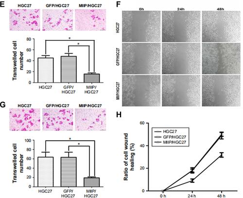 Figure 3 MIIP suppressed the invasion and migration of gastric cancer cells in vitro.